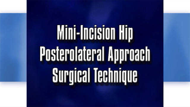 Mini-Incision Hip Posterolateral Approach Surgical Technique