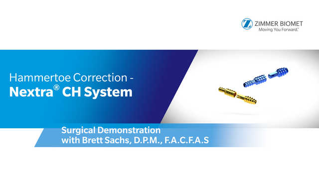 Hammertoe Correction- Nextra® CH System