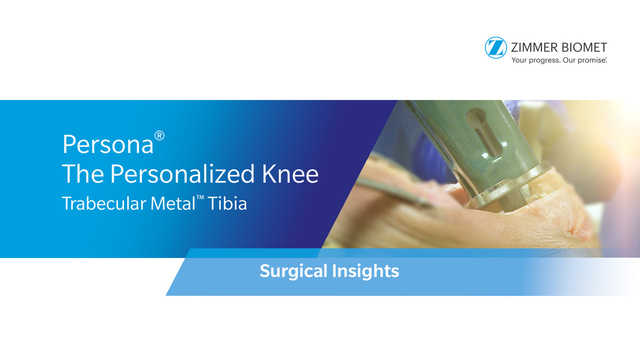 Persona® The Personalized Knee® Trabecular Metal™ Tibia Surgical Insights