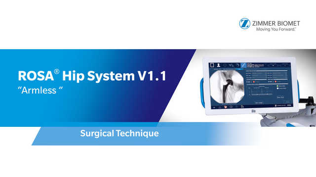 ROSA® Hip System V1.1 “Armless” Surgical Technique