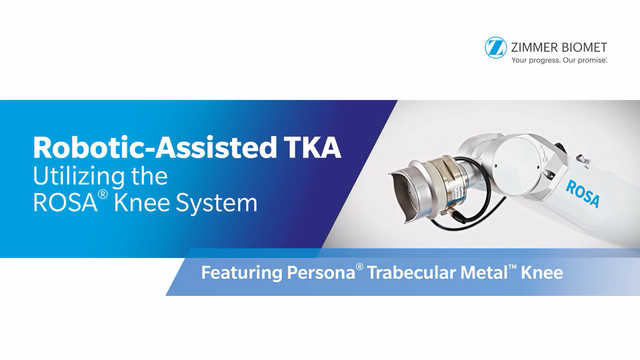 Robotic-Assisted TKA Utilizing the ROSA® Knee System Featuring Persona® Trabecular Metal™ Knee and the Persona® Medial Congruent Bearing