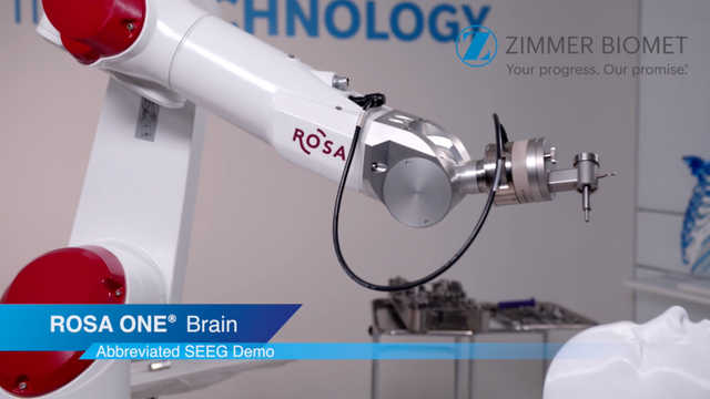 ROSA ONE Brain Abbreviated SEEG Demo