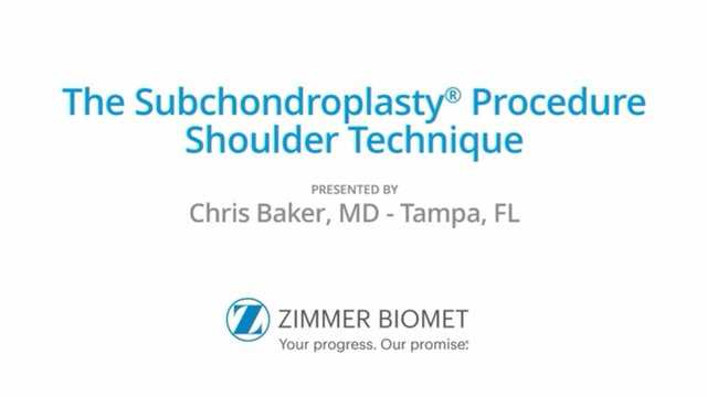The Subchondroplasty® (SCP®) Procedure Shoulder – Chris Baker, MD