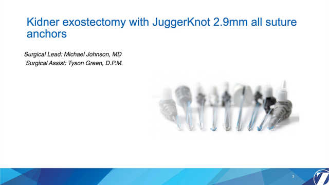 Kidner Exostectomy with JuggerKnot 2.9mm All Suture Anchor