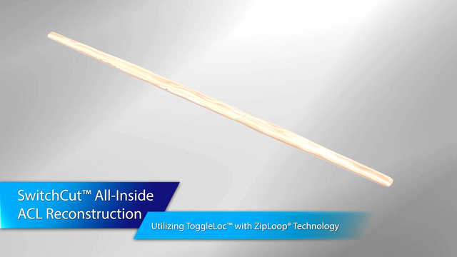 SwitchCut™ All-Inside ACL Reconstruction Utilizing ToggleLoc™ with ZipLoop® Technology