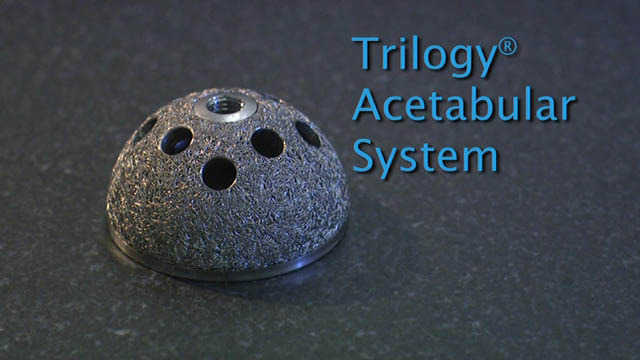 Trilogy® Acetabular System Manufacturing Video