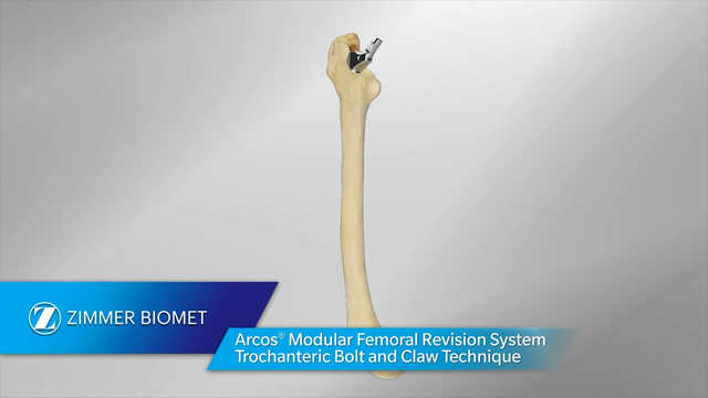 Arcos® Modular Femoral Revision System - Trochanteric Bolt and Claw Technique