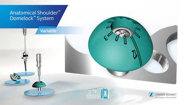 Anatomical Shoulder™ Domelock™ System Surgical Animation