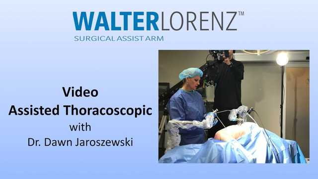 VIDEO ASSISTED THORACOSCOPIC with WalterLorenz®  Surgical Assist Arm 