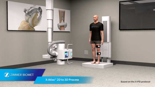 X-Atlas™ 2D to 3D Process