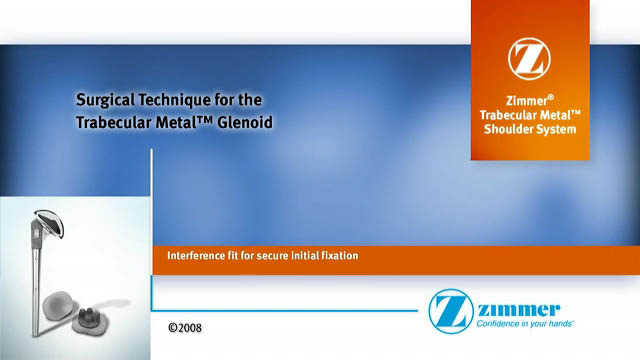 Zimmer® Trabecular Metal™ Shoulder System