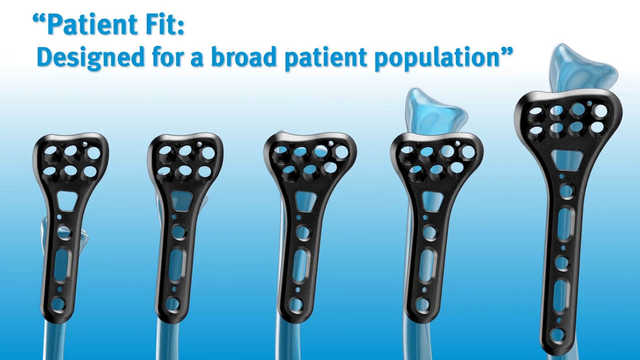  Zimmer® Distal Radius Plating System
