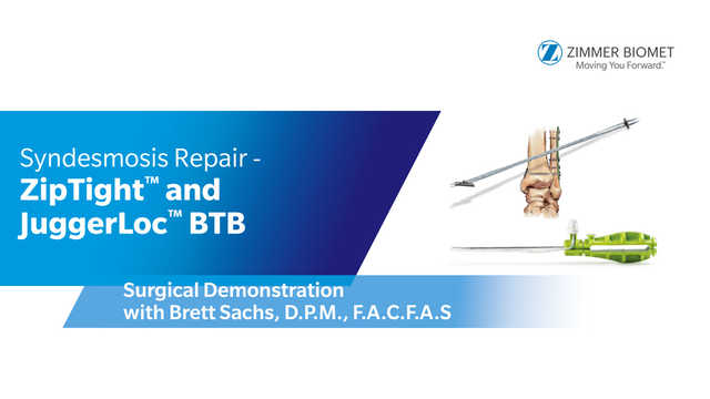 Syndesmosis Repair - ZipTight™ and JuggerLoc™ BTB