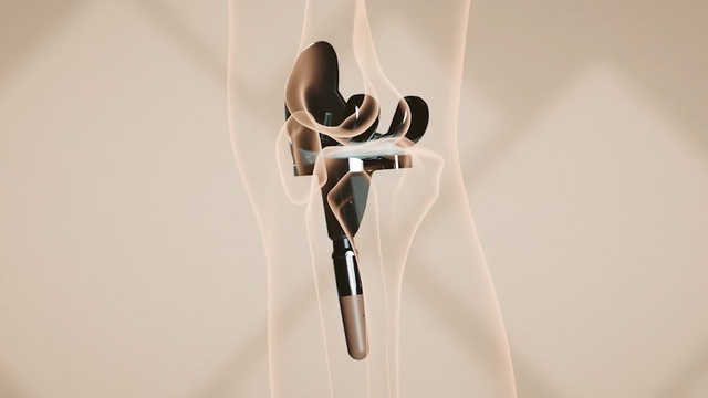 Persona IQ® The Smart Knee® Shortened Patient Brand Anthem