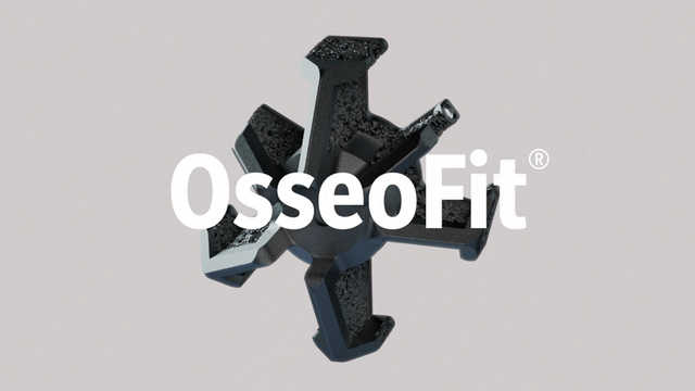 OsseoFit® Stemless Shoulder System -- Brand Anthem Video