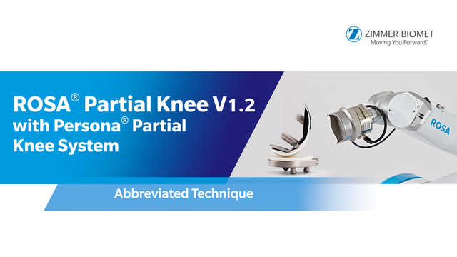 Persona® SoluTion™ Femur Surface Hardening Process Animation Persona® SoluTion™ Femur Surface Hardening Process Animation