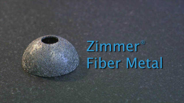 Zimmer® Fiber Metal Manufacturing