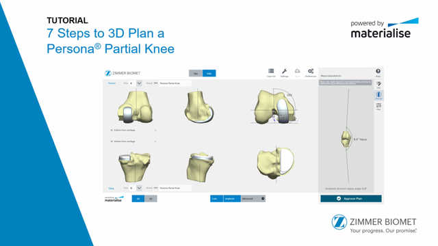 Persona® Partial Knee PSI 3D Planning Tutorial