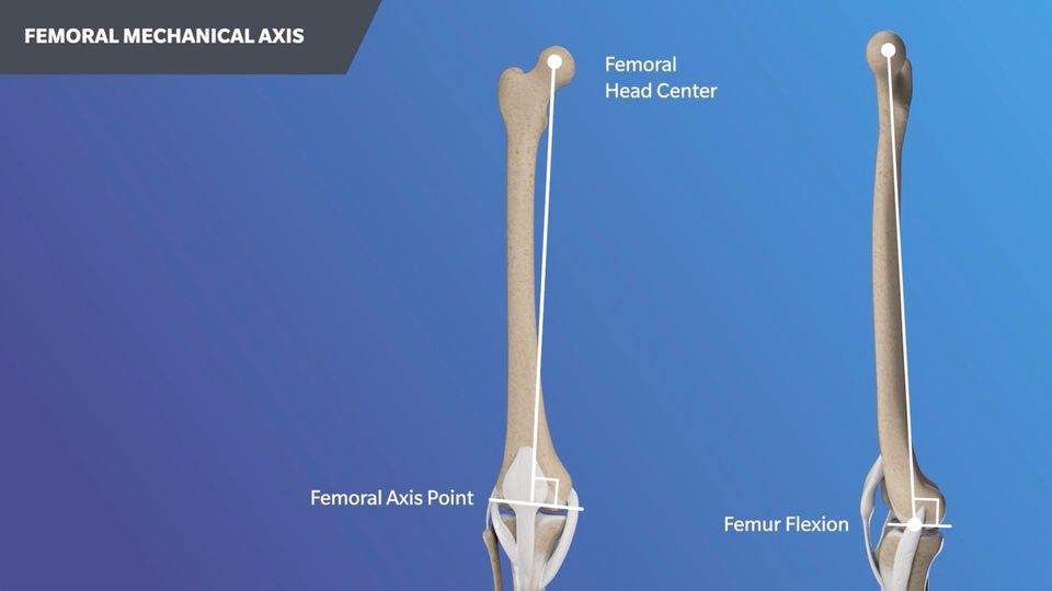 ROSA® Knee Landmarking Animation