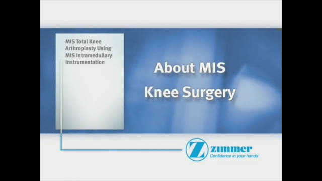 Zimmer® NexGen® LPS Fixed Bearing Knee