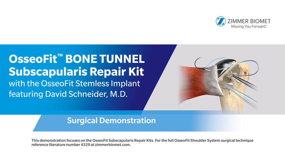 Comprehensive® Reverse Shoulder System Mini Humeral Tray