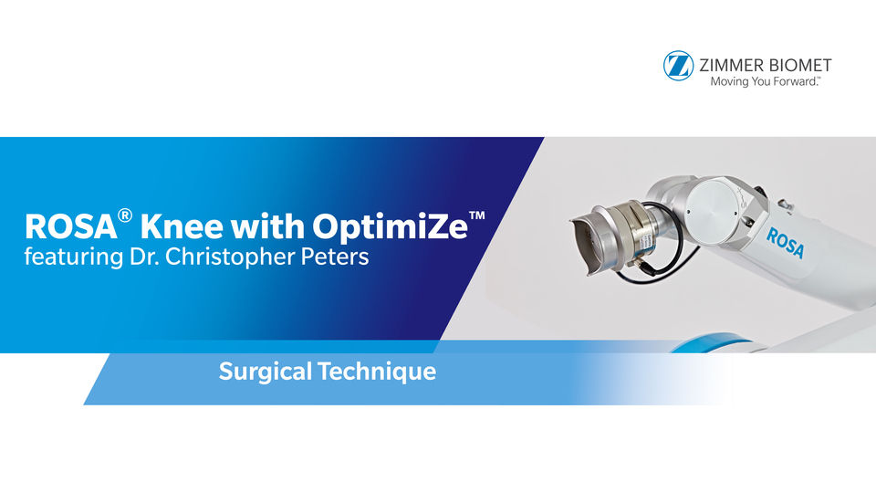 ROSA® Knee with OptimiZe™ Operating Room Setup - Femur and Tibia