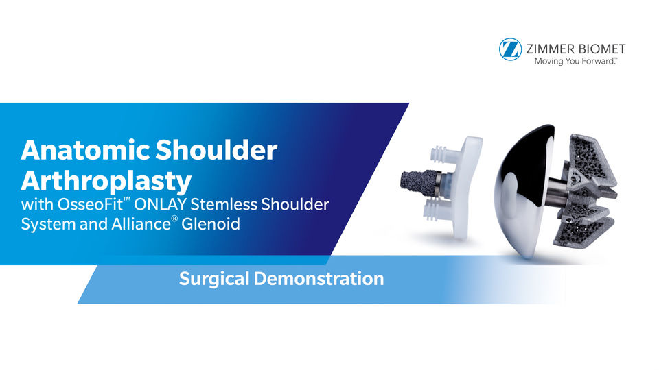 Anatomic Shoulder Arthroplasty with OsseoFit™ ONLAY Stemless