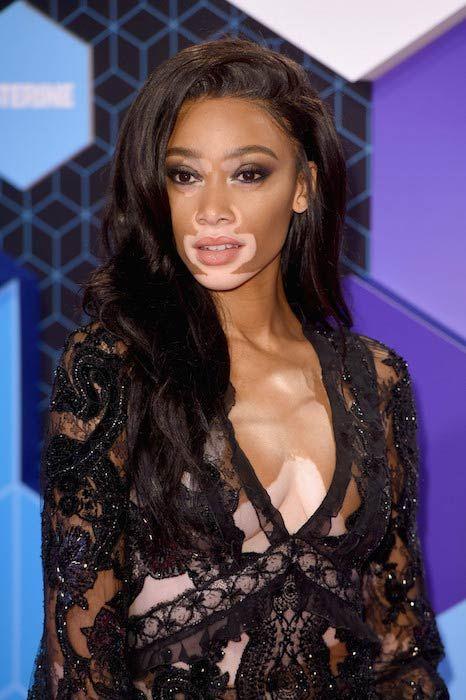 Winnie Harlow Photo #1