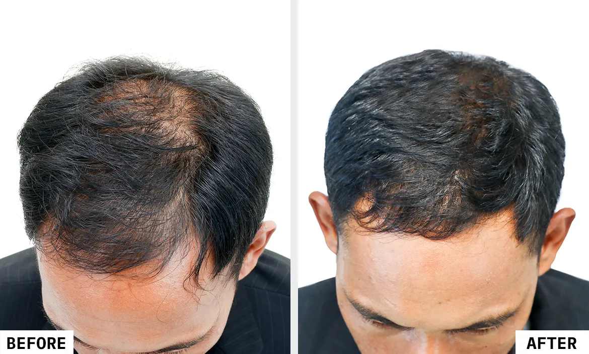 QR 678 Hair Treatment