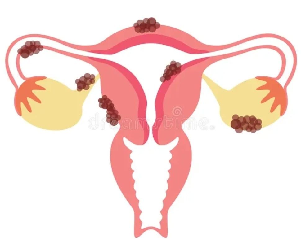 Women's Health