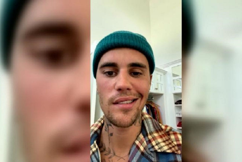 ޖަސްޓިން ބީބަރ، ޖެހުނު ބައްޔަކުން މޫނުގެ އެއްފަޅިން ވާގިނެތިފައި