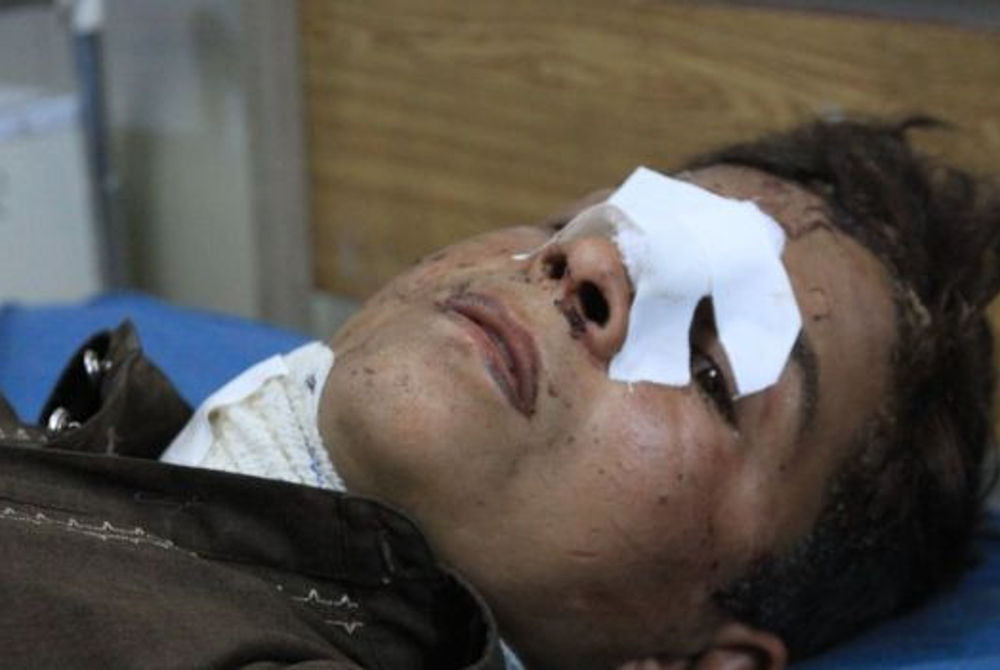 އަފްގާން ސަރުކާރުންނާ ސަރުކާރައް ބާރުދޭ ފަރާތްތަކުން ދިން ހަމަލާތަކުގައި އަހަރުގެ މިހާތަނަށް އާންމުންގެ 717 މީހުންވަނީ މަރުވެފައެވެ.