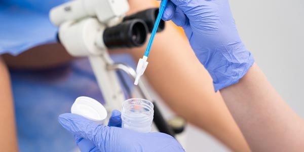 Pemeriksaan Pap Smear