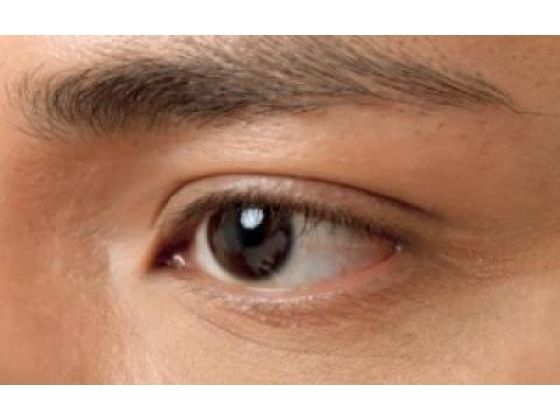 Glaucoma Is Destructive To Your Vision Health