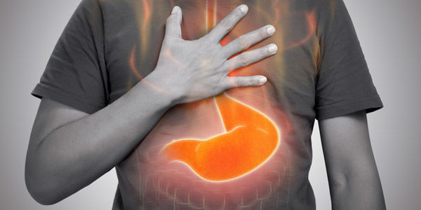 Heartburn salah satu gejala GERD