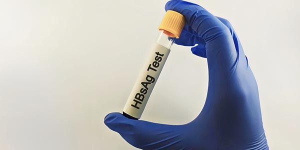 Test HBsAg