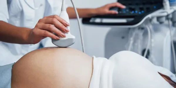 USG oleh Dokter Spesialis Obgyn