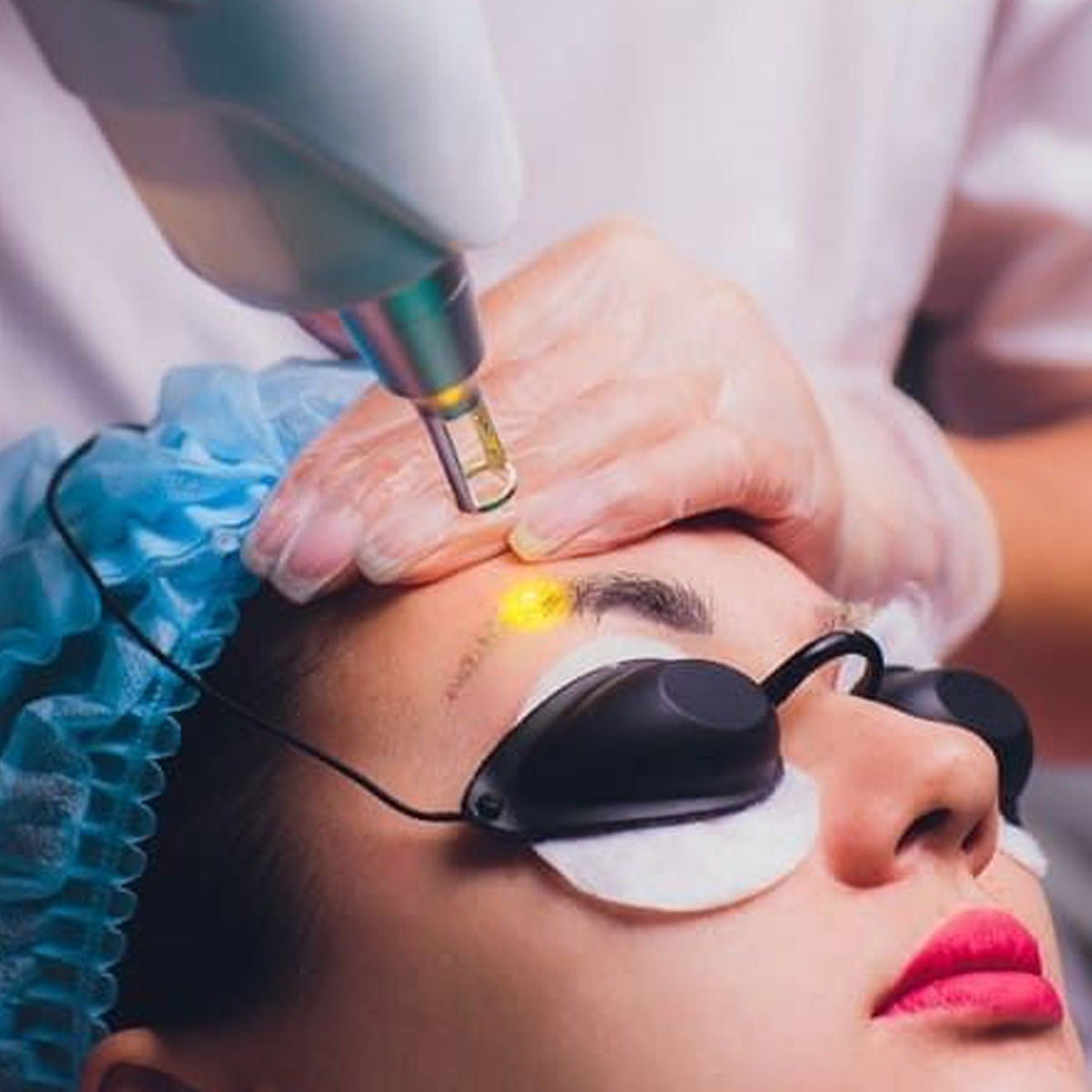Removedor de tatuajes cejas