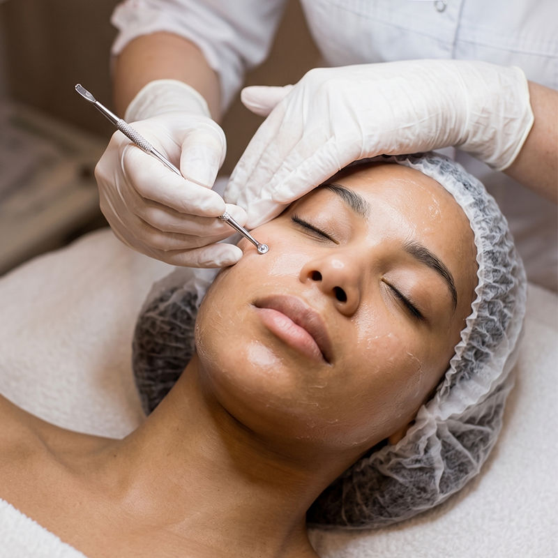 Facial profundo