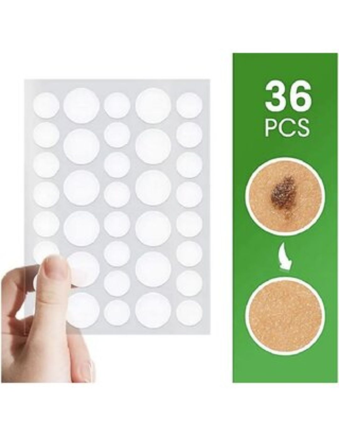 Acne and skin tag removal patches 36 pieces