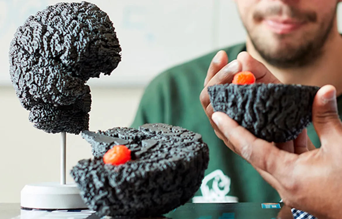 3D model of a brain