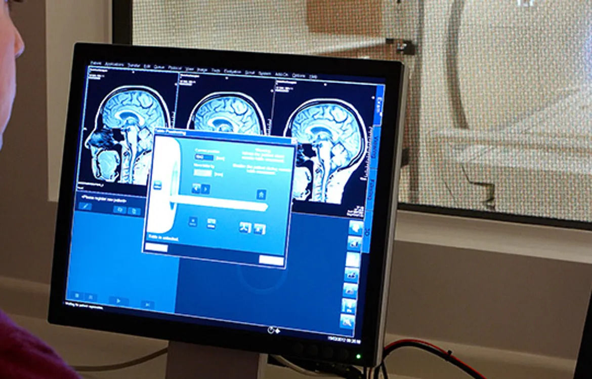 computer screen showing brain scans
