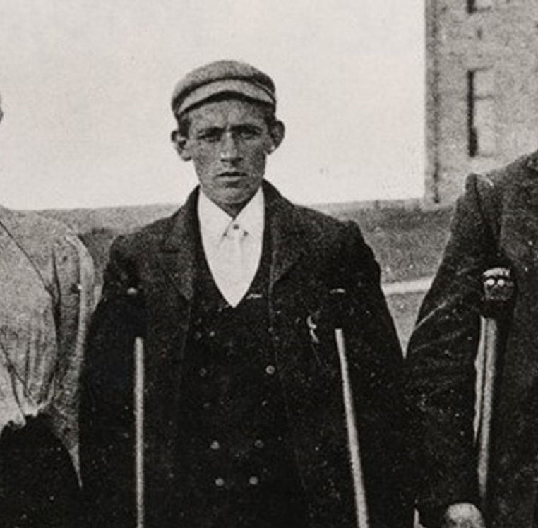 person on crutches