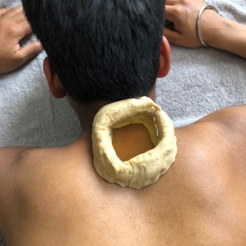 Cervical-in-Ayurveda-with-Griva-Basti