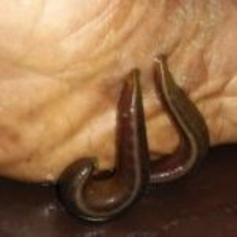 Medical-Leech-Therapy