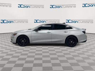 2017 Chevrolet Malibu — detail view