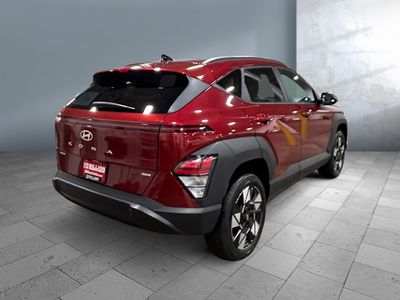 2025 Hyundai Kona — engine compartment view