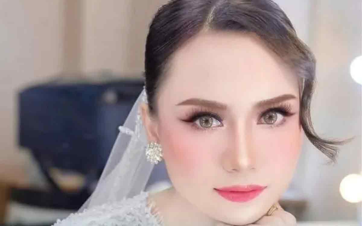 Seorang Model Jadi Korban Begal di Pinggir Tol Kebon Jeruk, Kondisinya Kritis