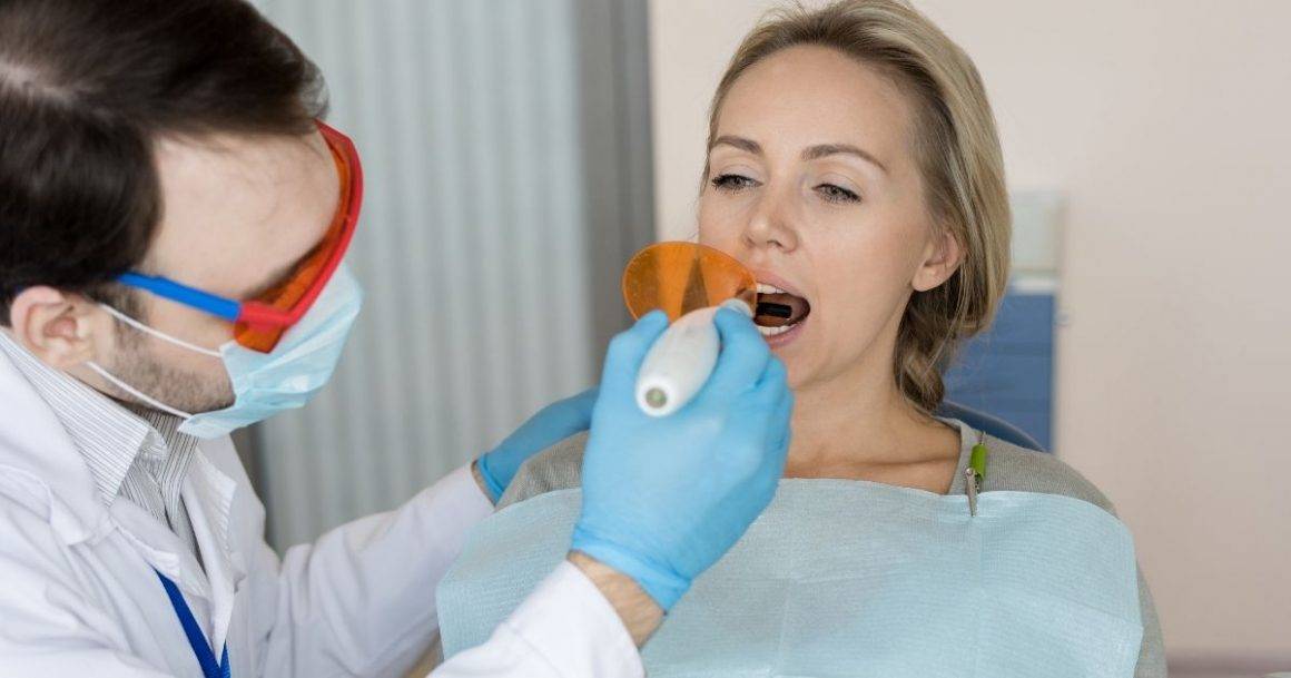 Dental Fillings | Tooth Colored Fillings