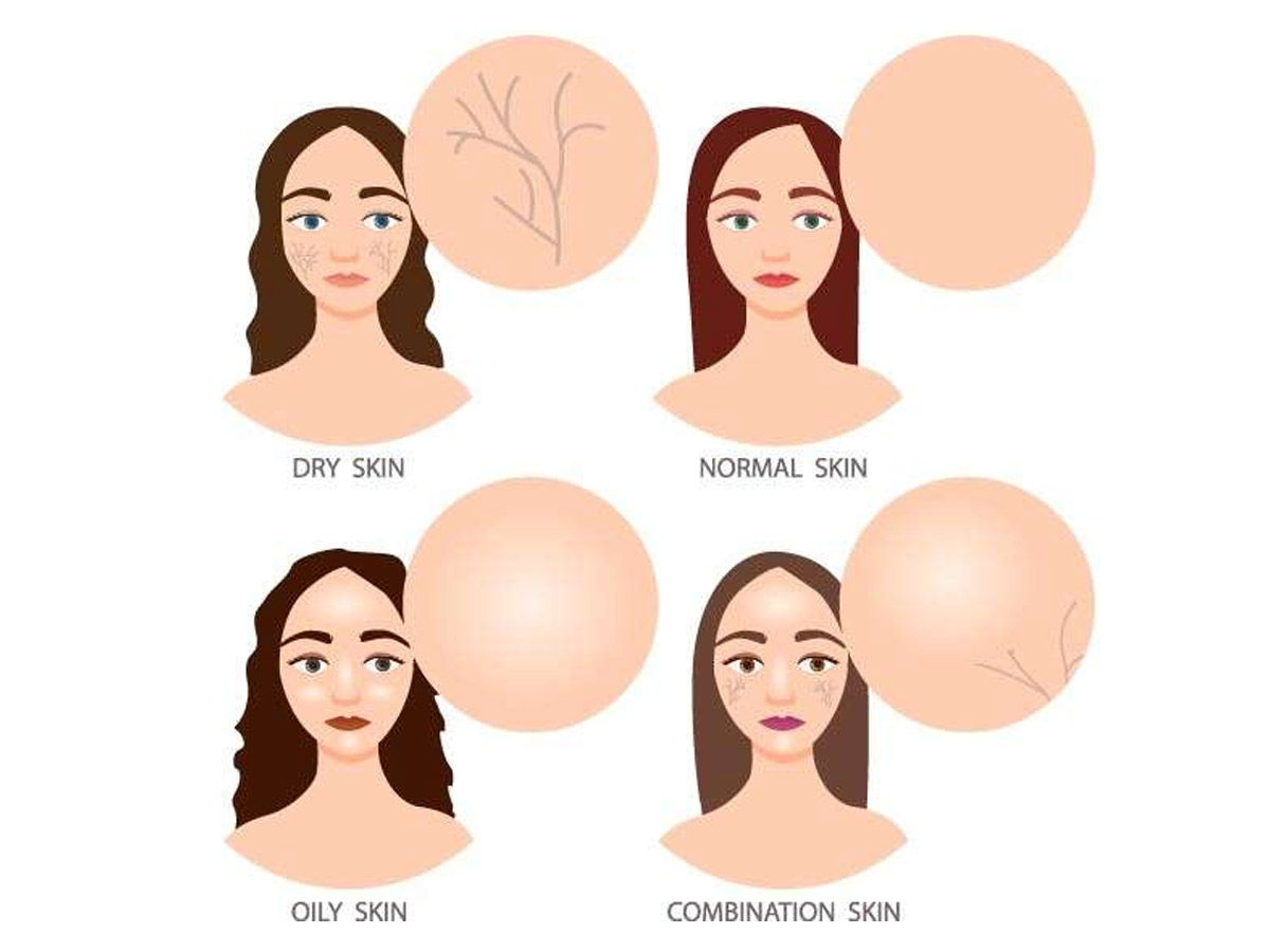 skin types